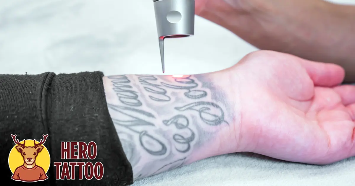 Cómo desvanecer un tatuaje