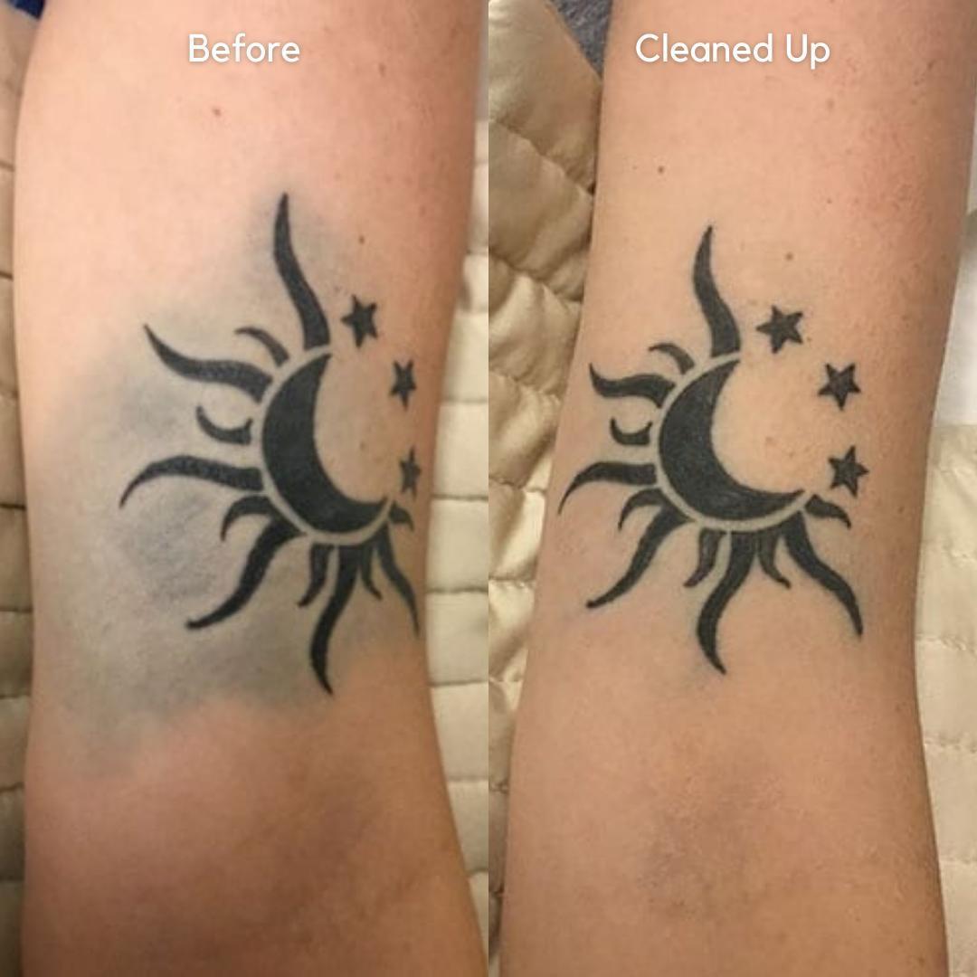 How to Fix Tattoo Blowout or Still Healing? Hero Tattoo