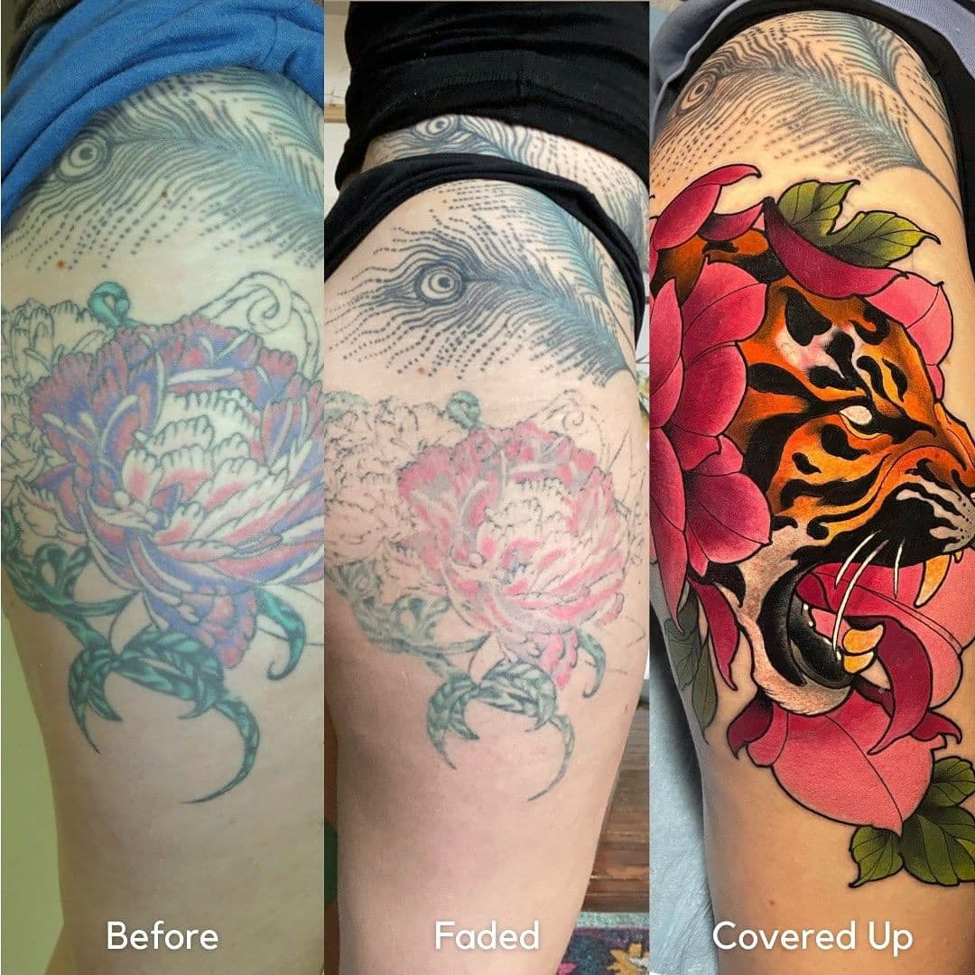 Tattoo Removal Why Multiple Sessions Are Needed 2