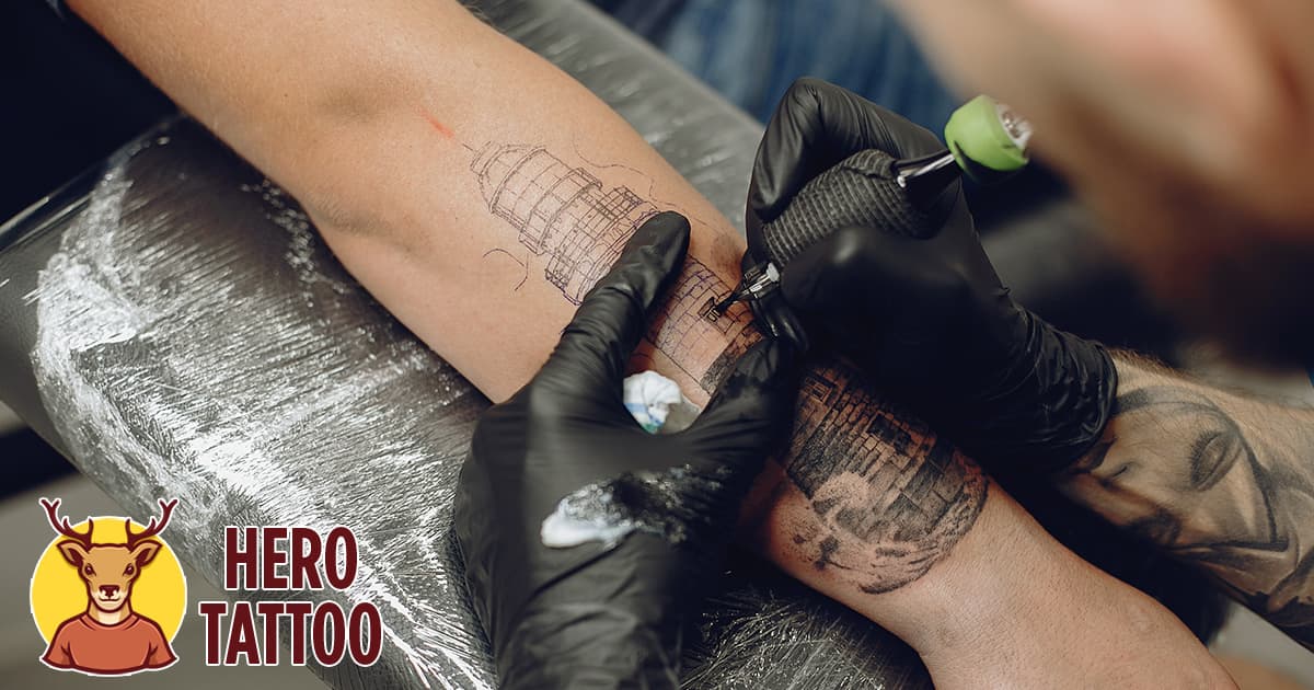 Eliminación de tatuajes Por qué son necesarias varias sesiones