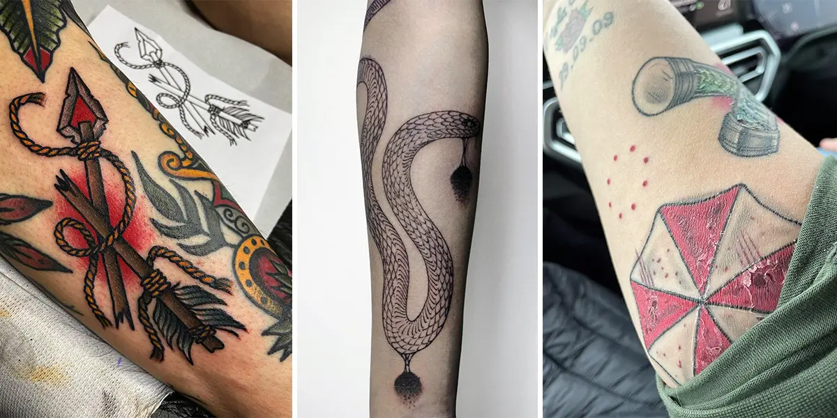 What Causes Tattoos to Be Itchy and Raised