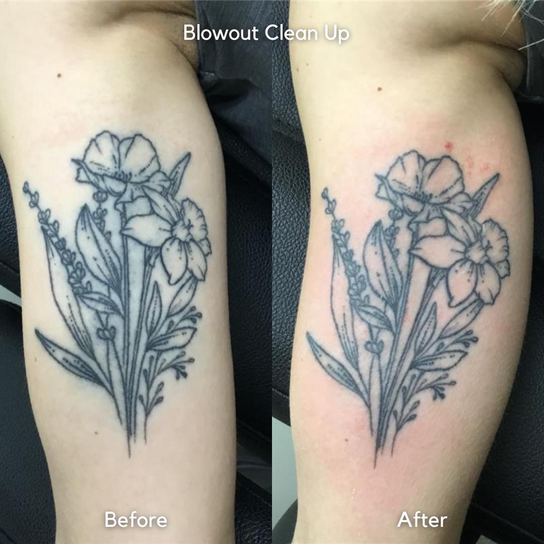 What Is A Tattoo Blowout Details Of 70+ Images And 18 Videos