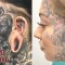¿cuáles son los riesgos de que la eliminación de los tatuajes provoque cicatrices?