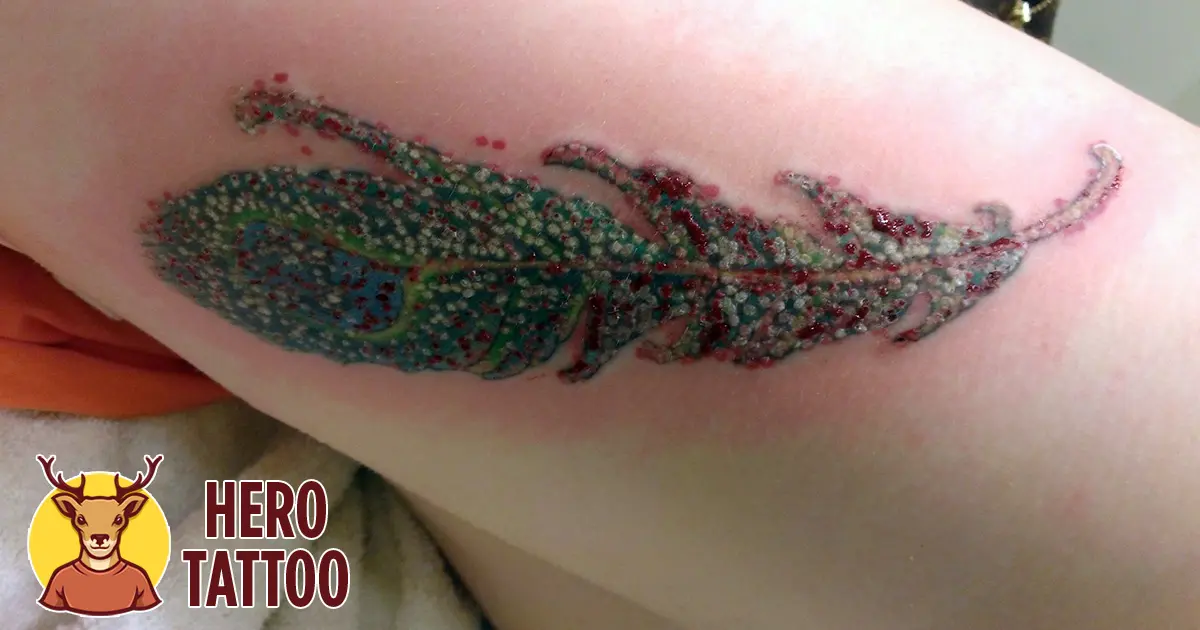 infección por tatuajes